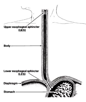 527 Barretts Esophagus 5 09 1